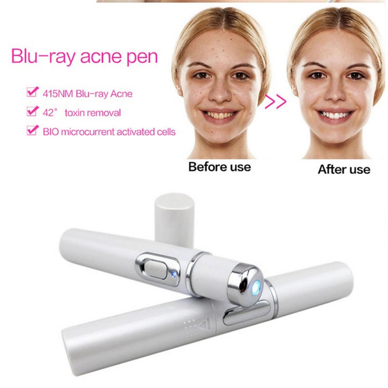 Blue Light Therapy Acne Laser Pen Soft Scar Wrinkle Removal Treatment Device Skin Care Beauty Equipment